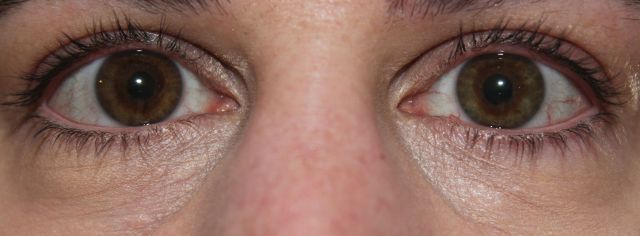 Pacifica Transcendent Concentrated Correcting Concealer (light)