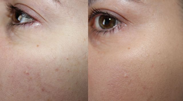 Left: No base, Right: Ellis Faas Skin Base in S102