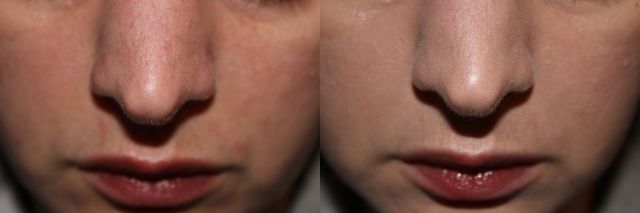 BandAHourglass Illuion