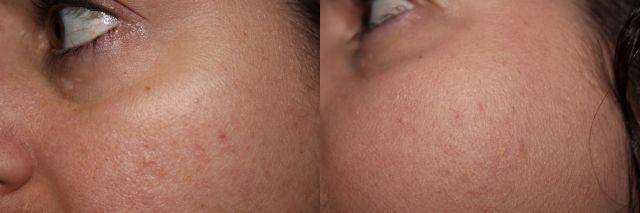 Left to Right: Bare, Hourglass Liquid Powder Foundation