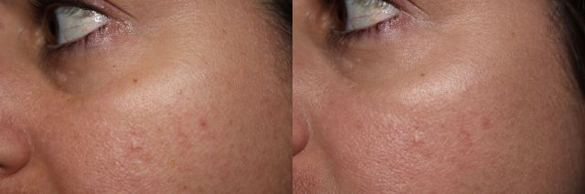 Left to Right: bare, ELF BB Cream