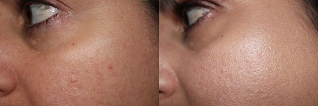 Left to Right: bare, Hourglass Illusion Hyaluronic Skin Tint in Shell