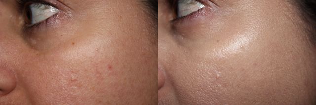 Left to Right: bare, Hourglass Tinted Moisturizer