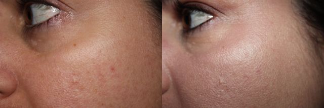 Left to Right: bare, It Cosmetics YSBB CC+ in Fair