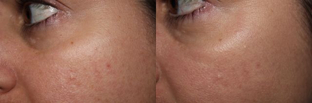 Left to Right: bare skin, Koh Gen Doh Aqua Foundation in OC-1
