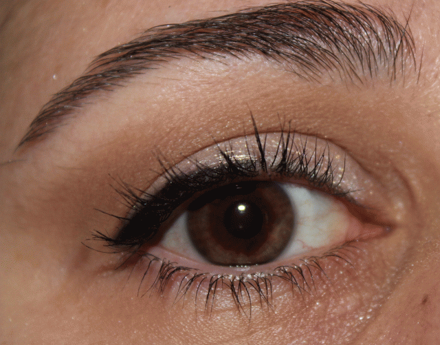 wedge liner, straight line technique